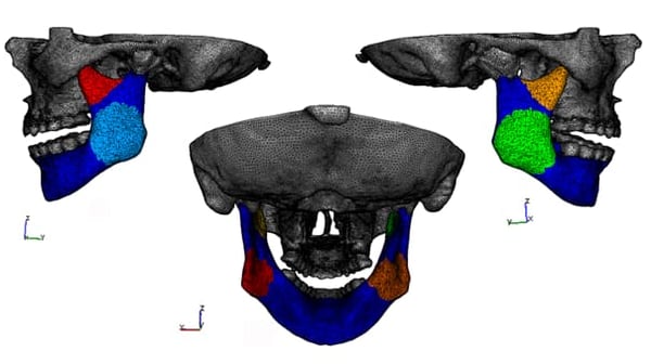 Demonstration deformable multi-body calculus